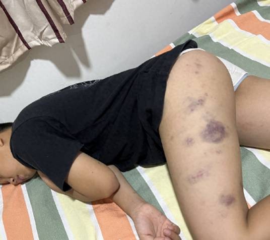 8·21青岛男童遭老师殴打事件