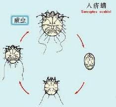 疥虫检查法