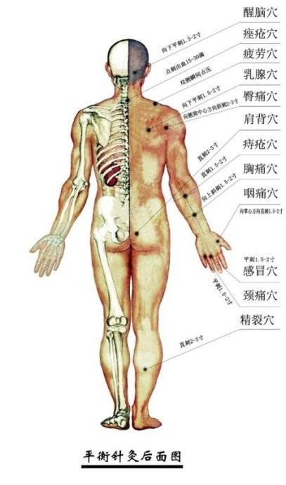 挑痔疗法